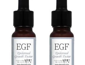 우리도 이렇게 하자 egf 30초면 확인 가능합니다